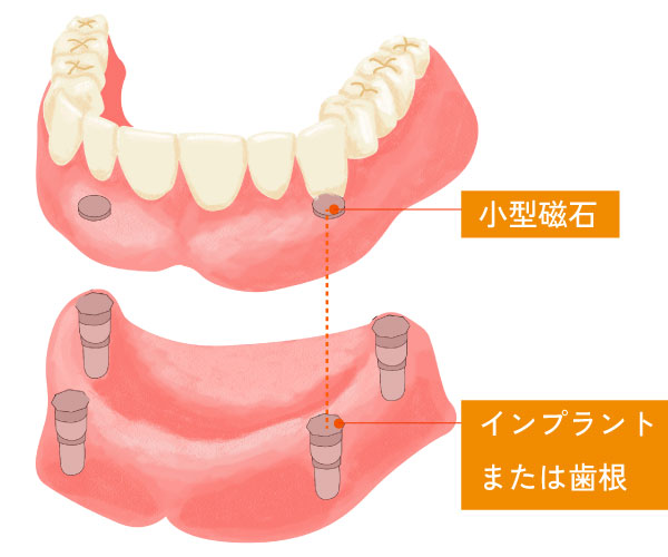 マグネット