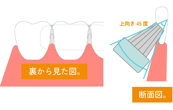 予防歯科