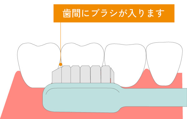 予防歯科